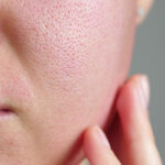 How to Diminish Pores on Face: Expert Skincare Strategies
