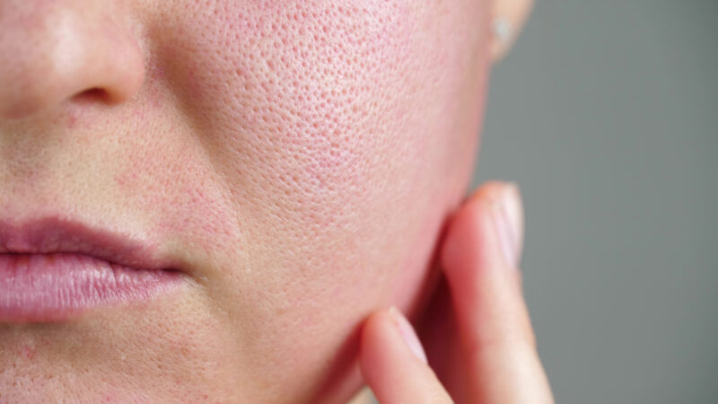 How to Diminish Pores on Face: Expert Skincare Strategies